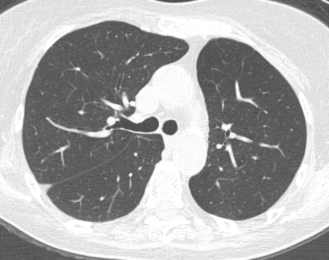 p2008 - clinical